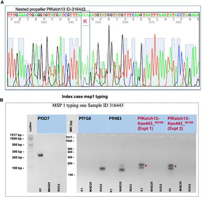 Identification of an in vitro artemisinin-resistant Plasmodium falciparum kelch13 R515K mutant parasite in Senegal
